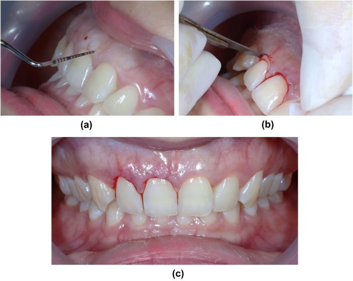 Figure 6