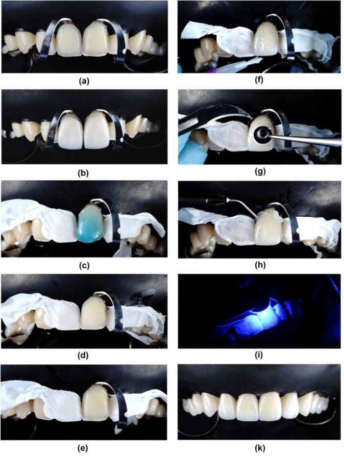 Figure 10