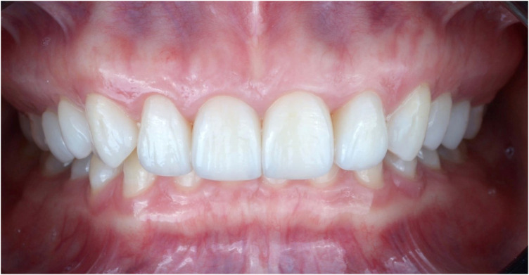 Figure 11