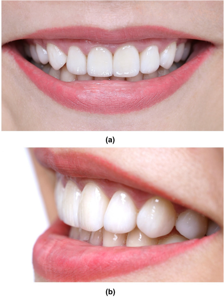Figure 12