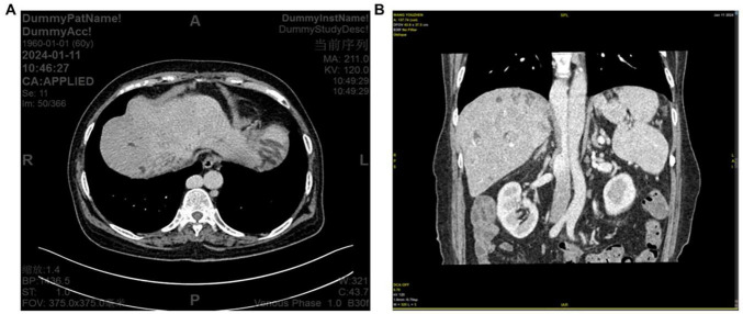 FIGURE 4