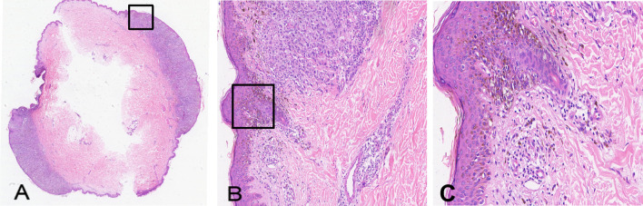 Figure 2