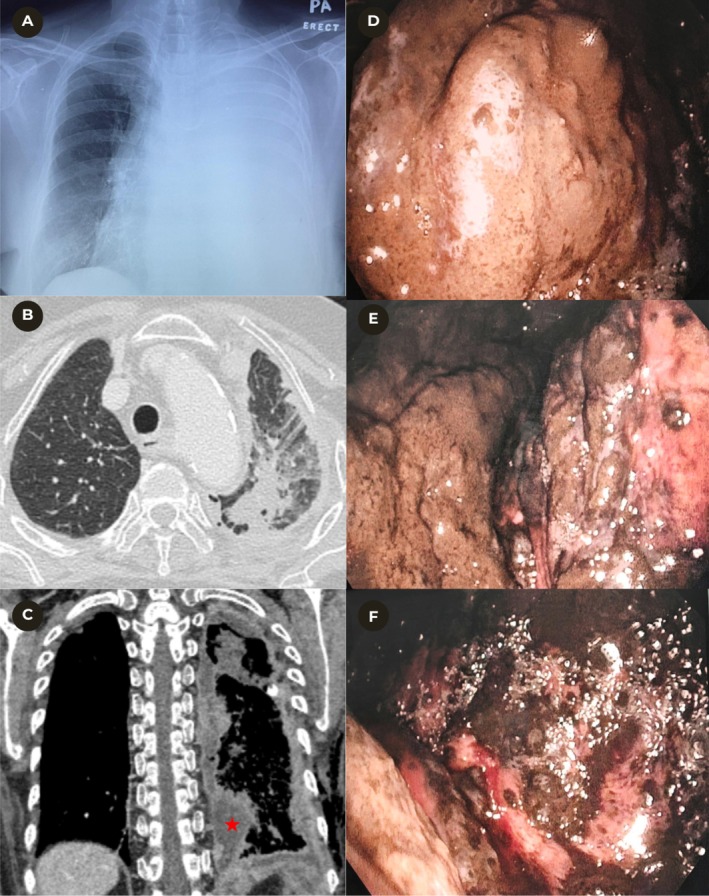 FIGURE 1