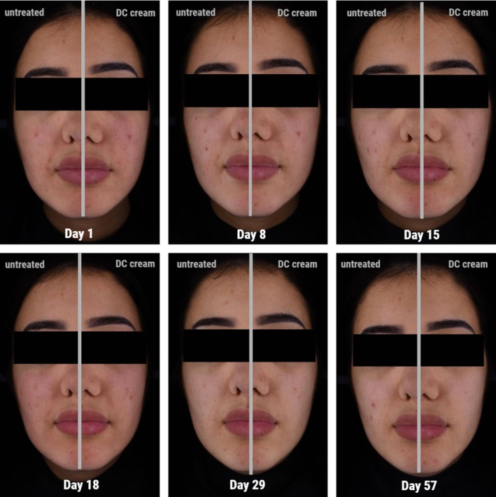 FIGURE 3