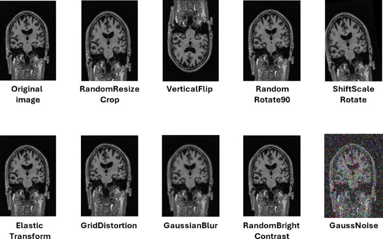Figure 11
