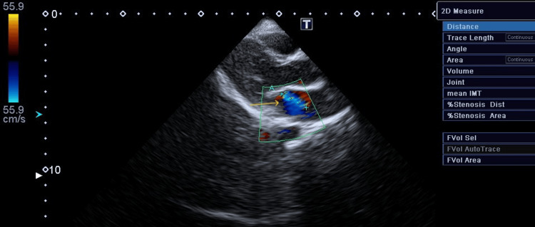 Figure 5