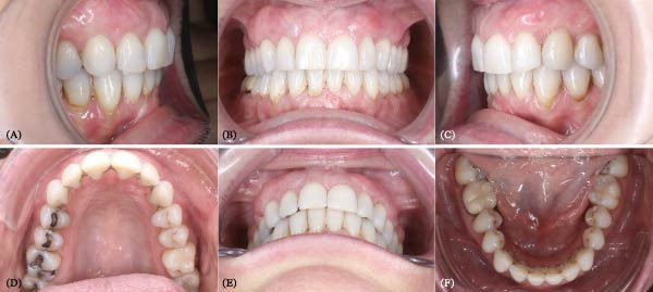 Figure 25