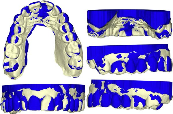Figure 17