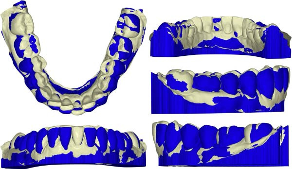 Figure 18