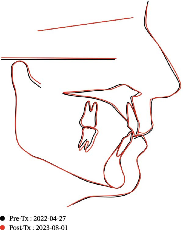 Figure 20