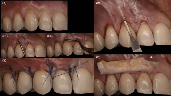 Figure 21