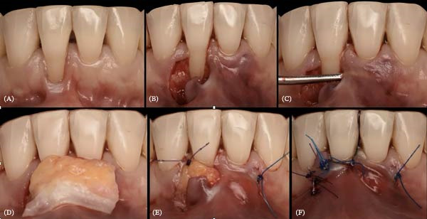 Figure 23