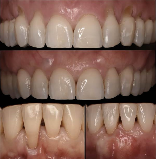 Figure 24