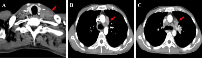 FIGURE 1