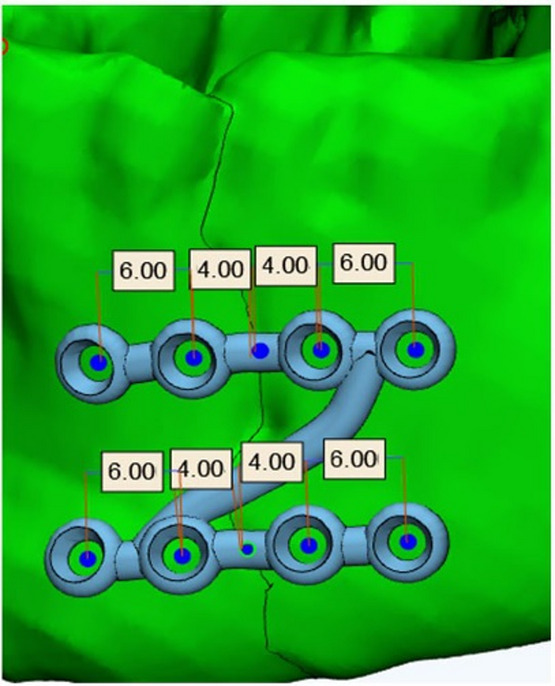 Figure 2