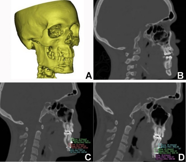 Figure 7