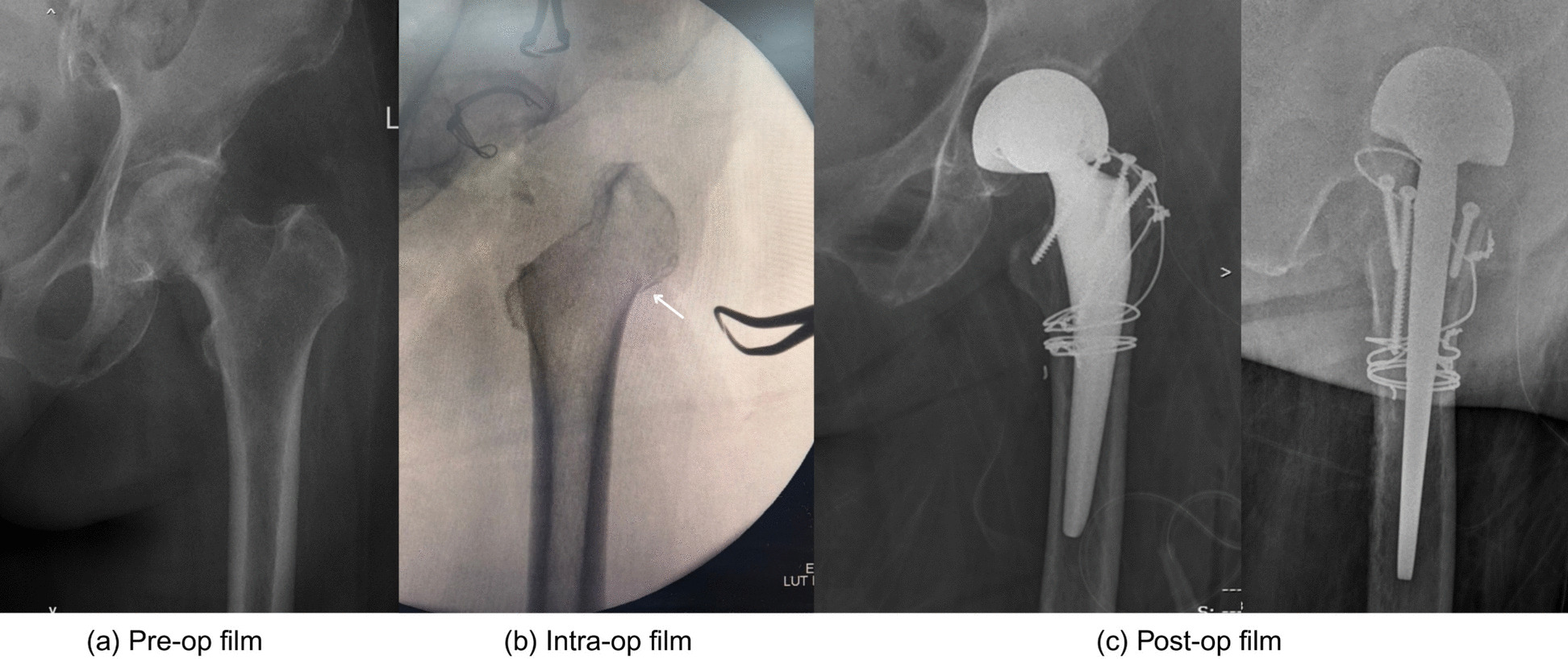 Figure 6