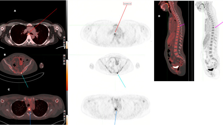 Fig 1