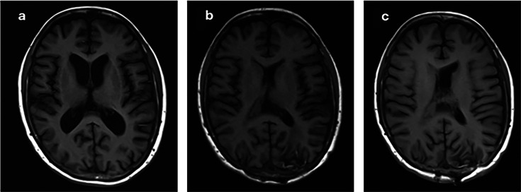 Fig 2