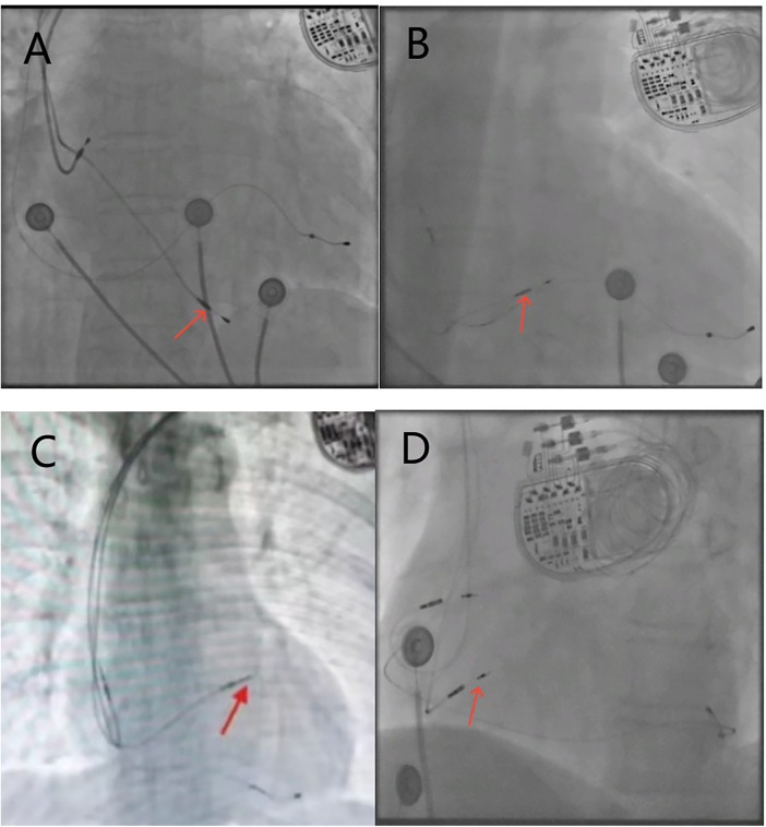 Figure 1