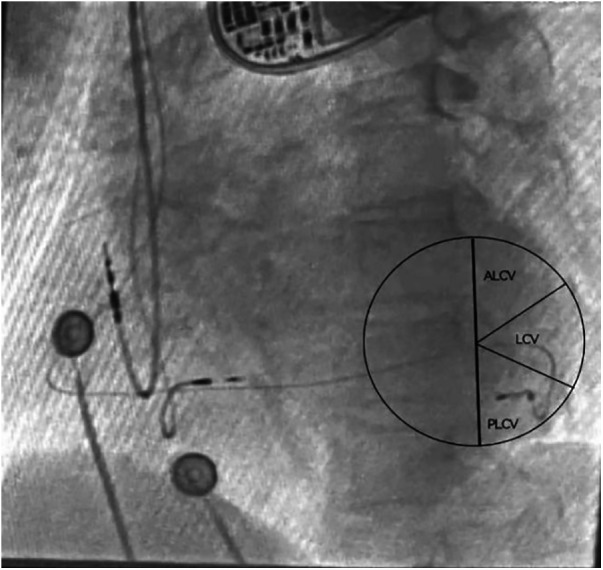 Figure 2