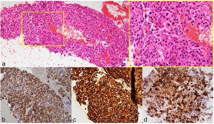 FIGURE 2