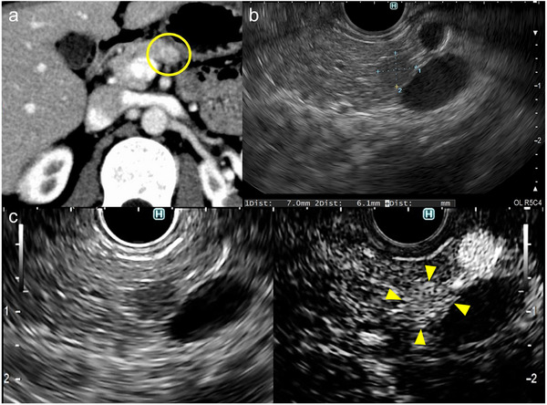 FIGURE 1