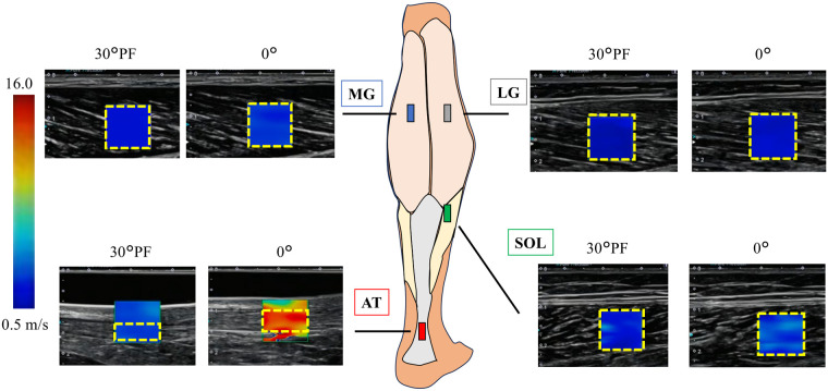 Figure 2
