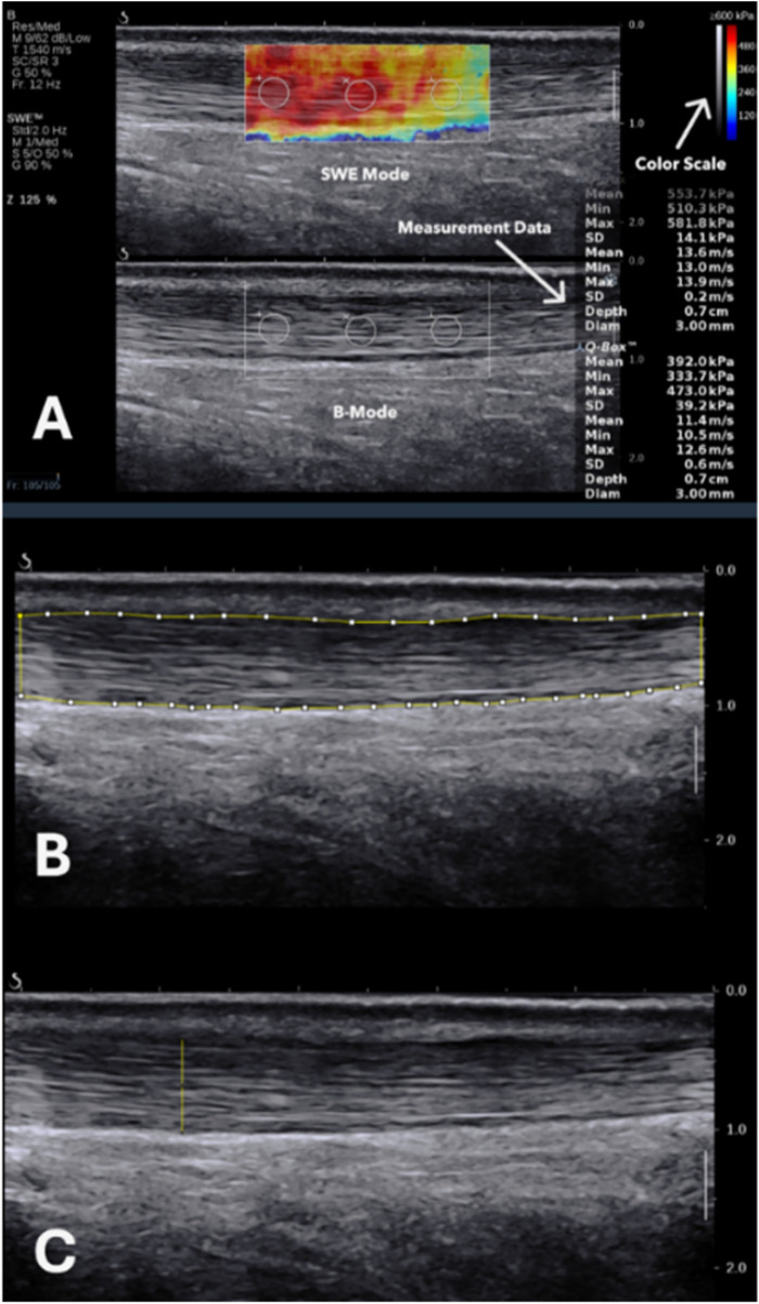 Figure 1