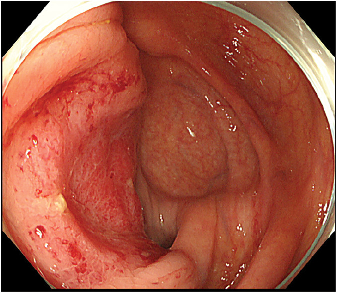 Fig. 2
