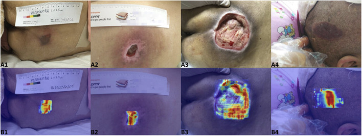 FIGURE 13