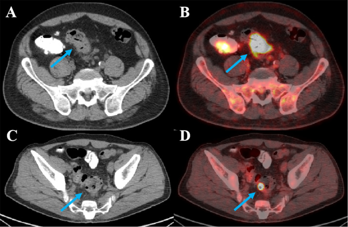 Figure 3