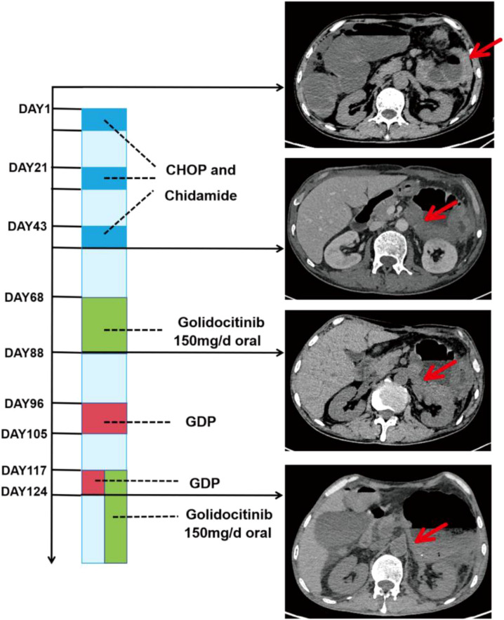 Figure 1