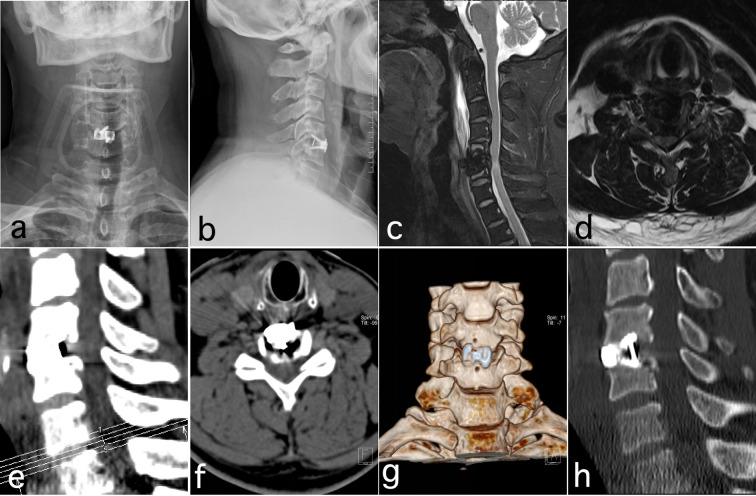 Figure 3