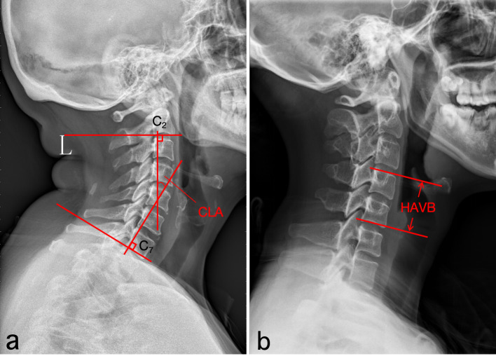 Figure 4