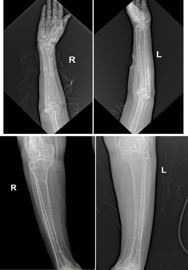 Figure 4