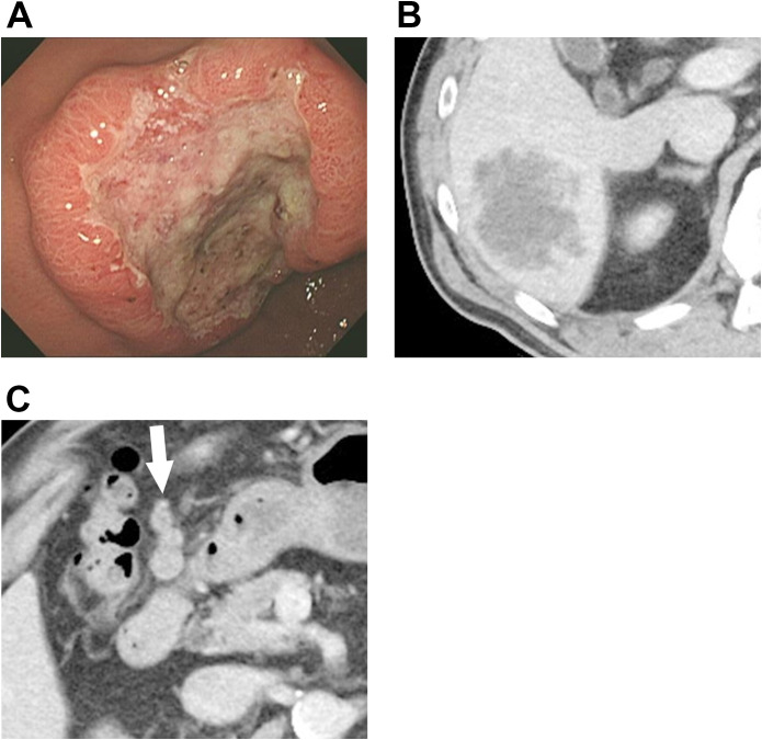 Figure 1