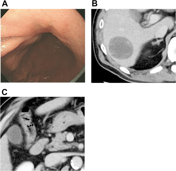 Figure 2