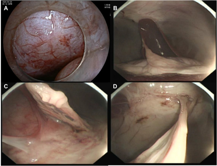 Figure 2