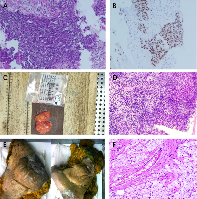 Figure 2