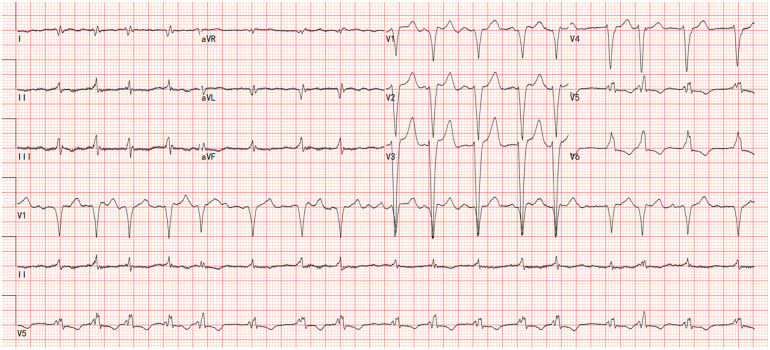 Figure 1