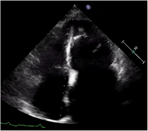 Figure 2