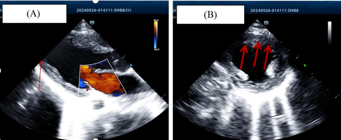 Figure 2