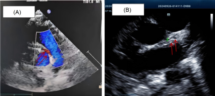 Figure 3