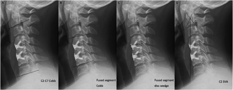 Figure 1