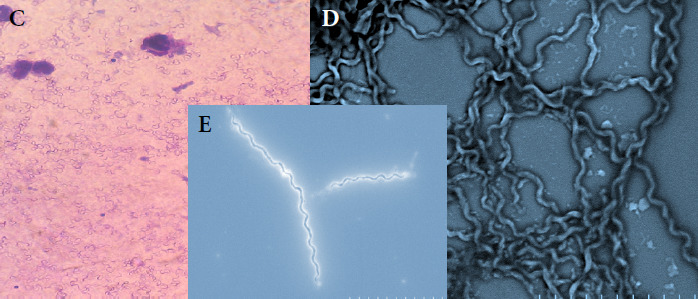 Figure 2B