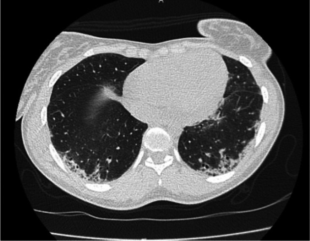 FIGURE 3