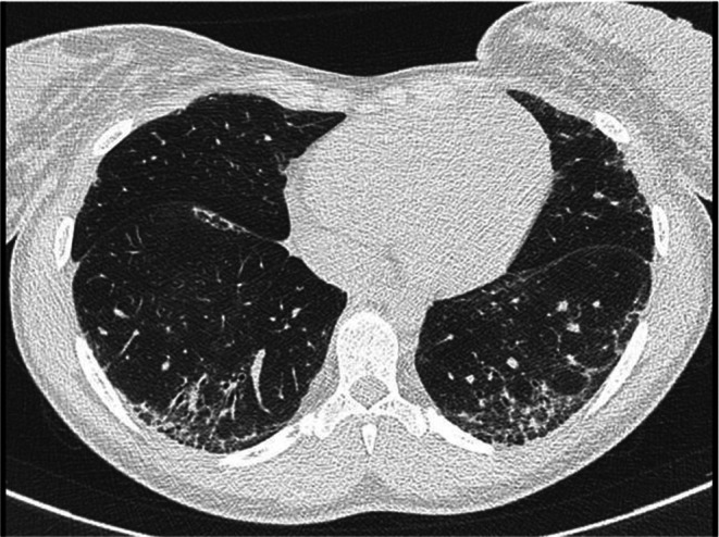 FIGURE 4