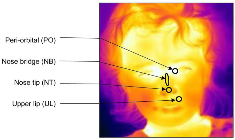 Fig 4