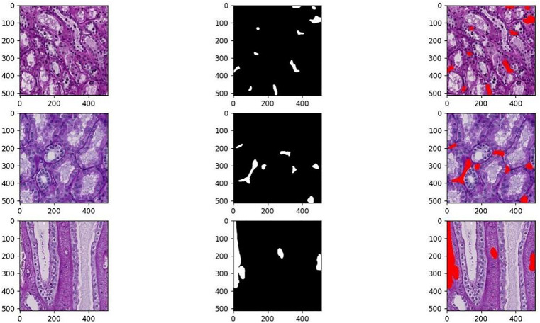 Fig 10